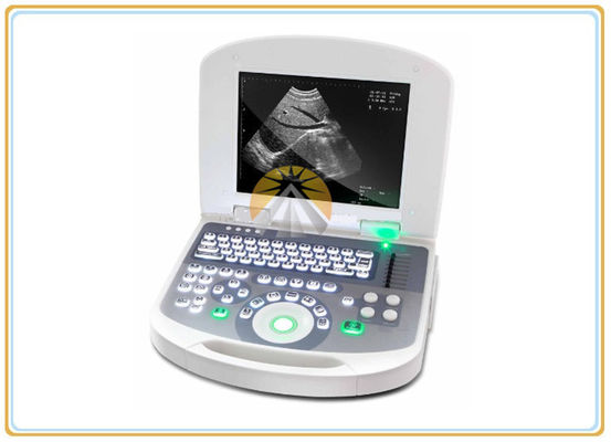 3.5MHz Convex Probe Ultrasound Scan Machine 2.5-8.0 MHz Frequency 64 Images Memory