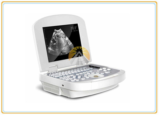 3.5MHz Convex Probe Ultrasound Scan Machine 2.5-8.0 MHz Frequency 64 Images Memory